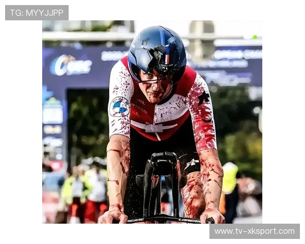 成都自行车赛伤员治疗进展鼓舞人心,2021年成都自行车比赛